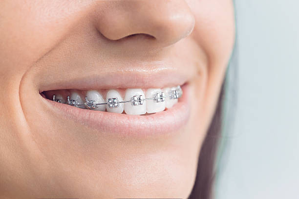 Best Wisdom Tooth Removal  in Maineville, OH